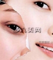 电波拉皮与手术拉皮有什么区别