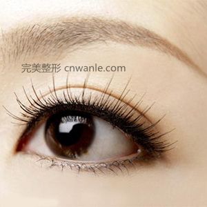 成都艺星开眼角手术效果怎么样