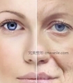电波拉皮多久做一次好?能维持多久?有用吗? 不吹不黑