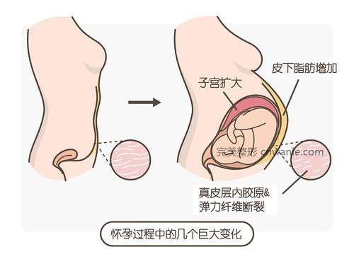 图片源自网络