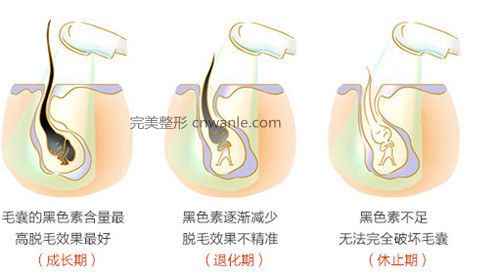 冰点华尔兹<a href='/tag_tuomao16.html'>脱毛</a>有什么优势