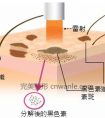 激光祛斑会有后遗症么