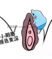 深圳阴唇漂红多少钱?深圳哪家医院技术好?