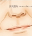 如何去除嘴角纹