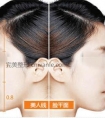 下颌角整形术大多是怎么收钱?贵不?