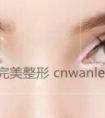 深圳开眼角手术的恢复时间要多久