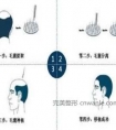纹发际线好还是植发际线好