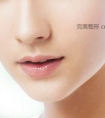 乐山经纬唇珠成形术是怎样做成的