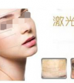 激光除皱大概可以维持多久的效果?