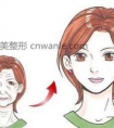 激光的主要功效有哪些 激光的除皱应用及功效介绍 (2)