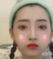 昆山激光除皱需要多少钱