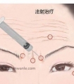 眼周皱纹祛除的3种方法及优劣势比较
