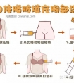 假体隆胸硅胶取出后要过多久才能从新再做假体隆胸?