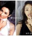 假体丰胸后胸部越来越硬是不是也是钙化了?