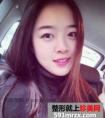 3个月效果鼻子变挺了,假体隆鼻案例图片