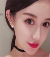 鼻子假体排异什么症状 鼻子假体为什么排异
