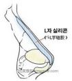 隆鼻后能做猪鼻子吗?