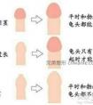 小儿包茎有什么症状,到底有多严重?