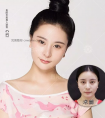 让厚唇变薄的唇部整形手术,打造性感嘴唇