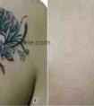 激光洗纹身后要怎么样护理