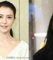 你以为女星都爱打玻尿酸瘦脸针?其实让他们变年轻的是面部埋线!!